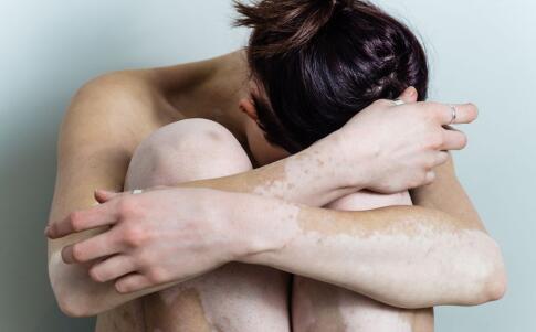 南通白癜风医院讲白癜风治疗医院怎么选