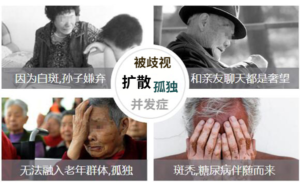 治疗白癜风无效的原因有哪些